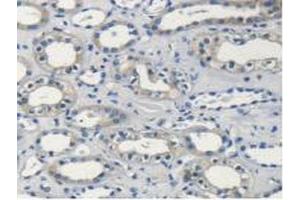Detection of PSMC4 in Human Kidney Tissue using Polyclonal Antibody to Proteasome 26S Subunit, ATPase 4 (PSMC4)