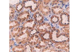 IHC-P analysis of kidney tissue, with DAB staining. (ECT2 Antikörper  (AA 453-647))