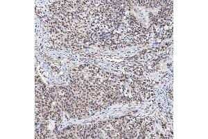 IHC analysis of U1A/SNRPA using anti-U1A/SNRPA antibody (ABIN7600891). (SNRPA1 Antikörper  (AA 25-218))