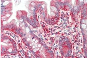Human Small Intestine: Formalin-Fixed, Paraffin-Embedded (FFPE) (TWEAK Antikörper  (Pro73))