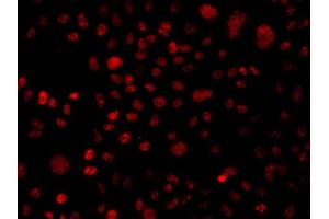 Immunofluorescence analysis of A549 cell using BAF250 antibody.