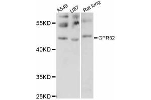 Western blot analysis of extracts of various cell lines, using GPR52 antibody (ABIN6292090) at 1:1000 dilution. (GPR52 Antikörper)