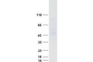 Western Blotting (WB) image for Aspartate beta-Hydroxylase Domain Containing 1 (ASPHD1) protein (Myc-DYKDDDDK Tag) (ABIN2715003)