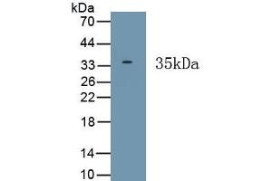 Detection of Recombinant HPS6, Human using Polyclonal Antibody to Hermansky Pudlak Syndrome Protein 6 (HPS6) (HPS6 Antikörper  (AA 500-775))