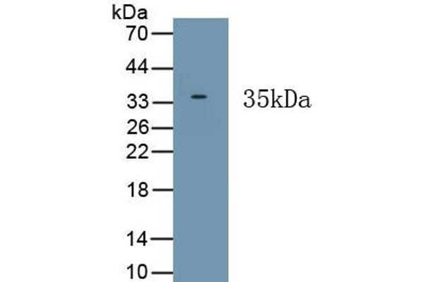HPS6 抗体  (AA 500-775)