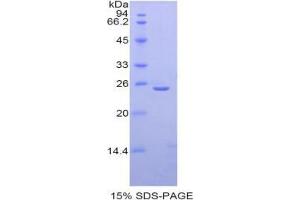 SDS-PAGE analysis of Mouse Thyroid Peroxidase Protein.