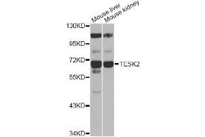Western blot analysis of extracts of various cell lines, using TESK2 antibody (ABIN6292305) at 1:1000 dilution. (TESK2 Antikörper)