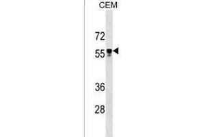 I5 Antibody (C-term) 18825b western blot analysis in CEM cell line lysates (35 μg/lane).