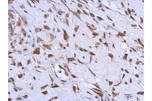 Immunohistochemistry (IHC) image for anti-Methylmalonic Aciduria (Cobalamin Deficiency) CblC Type, with Homocystinuria (MMACHC) (Center) antibody (ABIN2856443)