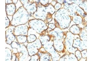 IHC testing of FFPE human placental tissue with recombinant Insulin Receptor alpha antibody (clone INSR/2277R).