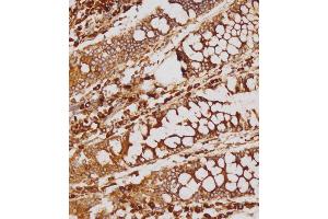 Immunohistochemical analysis of (ABIN1539214 and ABIN2838155) on paraffin-embedded human colon tissue was performed on the Leica®BOND RXm. (GATSL2 Antikörper  (N-Term))