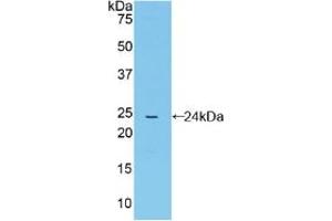 Western blot analysis of recombinant Mouse CYPD. (PPID Antikörper  (AA 9-189))