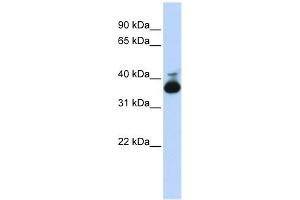 ALDOB antibody used at 1 ug/ml to detect target protein. (ALDOB Antikörper  (Middle Region))