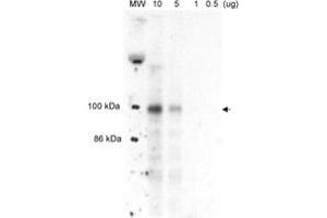 Western blot analysis of MLXIPL in liver nuclear extracts from well-fed rats. (MLXIPL Antikörper  (AA 800-852))