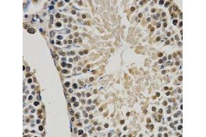 Immunohistochemistry of paraffin-embedded Rat testis using MonoMethyl-Histone H3-K9 Polyclonal Antibody at dilution of 1:200 (40x lens).