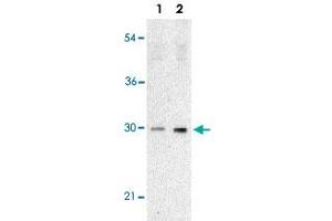 Western blot analysis of TP53INP1 expression in human lung tissue lysate with TP53INP1 polyclonal antibody  at 2 ug/mL in the absence (lane 1) or presence (lane 2) of blocking peptide. (TP53INP1 Antikörper  (C-Term))