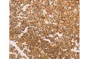 Immunohistochemistry (IHC) image for anti-Telomerase Reverse Transcriptase (TERT) antibody (ABIN1875058) (TERT Antikörper)