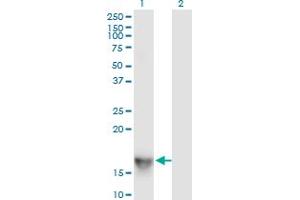 Western Blot analysis of SH2D1A expression in transfected 293T cell line by SH2D1A monoclonal antibody (M01), clone 1C9. (SH2D1A Antikörper  (AA 1-128))