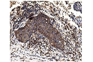 IHC analysis of Alkaline phosphatase/ALPL using anti-Alkaline phosphatase/ALPL antibody (ABIN7603162).