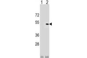 Western Blotting (WB) image for anti-Pleckstrin Homology Domain Containing, Family A (phosphoinositide Binding Specific) Member 1 (PLEKHA1) antibody (ABIN3000047) (PLEKHA1 Antikörper)