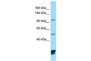 WB Suggested Anti-CTNND2 Antibody Titration: 1.