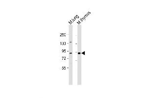 Western Blot at 1:1000 dilution Lane 1: mouse lung lysate Lane 2: mouse thymus lysate Lysates/proteins at 20 ug per lane. (PARP9 Antikörper  (AA 599-629))