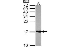 WB Image Sample (30 ug of whole cell lysate) A: JurKat 15% SDS PAGE antibody diluted at 1:1000