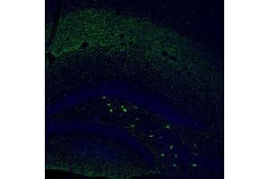 Immunofluorescent staining of mouse dentate gyrus shows moderate to strong positivity in a subset of neurons in the polymorph layer.