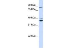 Image no. 1 for anti-Chromosome 18 Open Reading Frame 10 (C18orf10) (AA 108-157) antibody (ABIN6741301) (TPGS2 Antikörper  (AA 108-157))