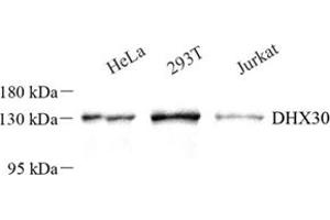 Western blot analysis of DHX30 (ABIN7073703) at dilution of 1: 250 (DHX30 Antikörper)