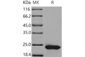 Western Blotting (WB) image for Retinol Binding Protein 4, Plasma (RBP4) (Active) protein (His tag) (ABIN7321242)