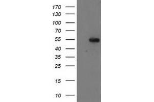 Western Blotting (WB) image for anti-Glucosidase, Beta, Acid 3 (Cytosolic) (GBA3) (AA 1-150), (AA 370-469) antibody (ABIN1490583) (GBA3 Antikörper  (AA 1-150, AA 370-469))