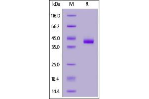 Fed Human Nectin-4, His Tag on  under reducing (R) condition. (PVRL4 Protein (AA 32-349) (His tag,FITC))