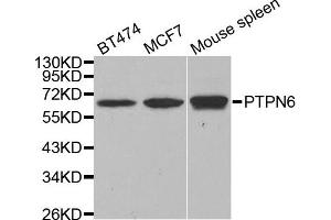 Western blot analysis of extracts of various cell lines, using PTPN6 antibody. (SHP1 Antikörper)