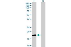 Western Blot analysis of LY96 expression in transfected 293T cell line by LY96 MaxPab polyclonal antibody.