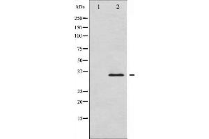Western blot analysis of IkappaB-alpha expression in HuvEc whole cell lysates,The lane on the left is treated with the antigen-specific peptide. (NFKBIA Antikörper  (C-Term))