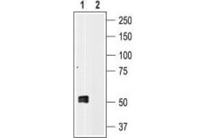 Western blot analysis of human platelet lysates: - 1. (P2RX1 Antikörper  (C-Term, Intracellular))