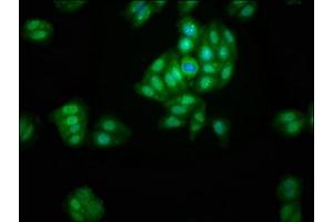 Immunofluorescence staining of HepG2 cells with ABIN7143578 at 1:200, counter-stained with DAPI. (AFG1-Like ATPase (AFG1L) (AA 14-313) Antikörper)