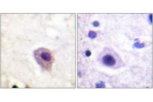 Immunohistochemistry analysis of paraffin-embedded human brain, using DRP-2 (Phospho-Thr514) Antibody. (DRP2 Antikörper  (pThr514))