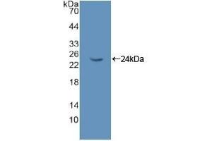 Detection of Recombinant NME6, Rat using Polyclonal Antibody to Non Metastatic Cells 6, Protein Expressed In (NME6) (Non Metastatic Cells 6, Protein Expressed In (AA 1-173) Antikörper)