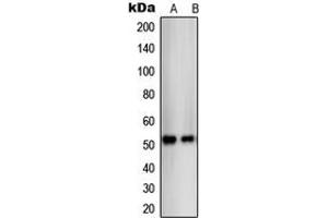 Western blot analysis of THRB expression in SKBR3 (A), C32 (B) whole cell lysates.