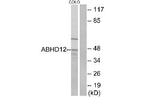 Western blot analysis of extracts from COLO cells, using ABHD12 antibody. (ABHD12 Antikörper)
