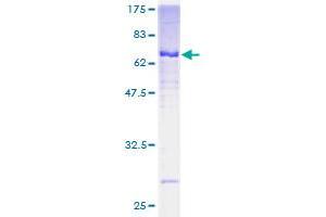 ADAP2 Protein (AA 1-380) (GST tag)