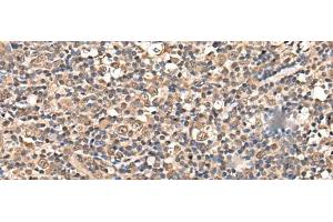 Immunohistochemistry of paraffin-embedded Human tonsil tissue using ZSCAN12 Polyclonal Antibody at dilution of 1:50(x200) (ZSCAN12 Antikörper)