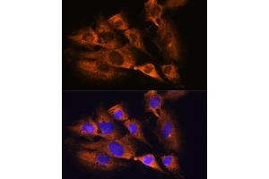 Immunofluorescence analysis of C6 cells using ACHE Rabbit pAb (ABIN3016742, ABIN3016743, ABIN3016744 and ABIN6219831) at dilution of 1:100.