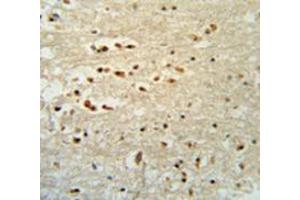 Immunohistochemistry analysis in human brain tissue (Formalin-fixed, Paraffin-embedded) using PTOV1  Antibody  (N-term), followed by peroxidase conjugated secondary antibody and DAB staining.