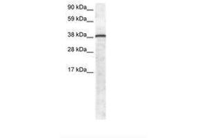 Image no. 1 for anti-Growth Factor Independent 1 (GFI1) (AA 32-81) antibody (ABIN6735896)
