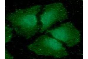 ICC/IF analysis of CIB1 in HeLa cells line, stained with DAPI (Blue) for nucleus staining and monoclonal anti-human CIB1 antibody (1:100) with goat anti-mouse IgG-Alexa fluor 488 conjugate (Green).