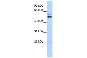 PRMT2 antibody used at 1 ug/ml to detect target protein. (PRMT2 Antikörper  (N-Term))