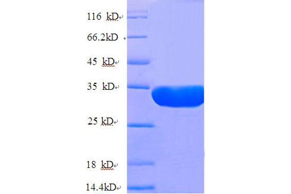 NUP210 Protein (AA 1529-1808, partial) (His tag)